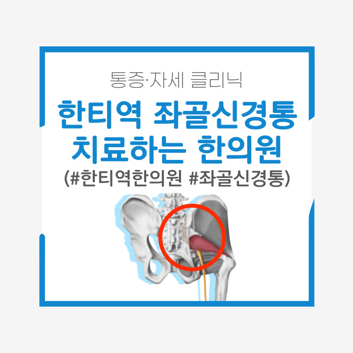  한티역 좌골신경통 한의원, 척추 고정(fixation)을 치료하는 법
