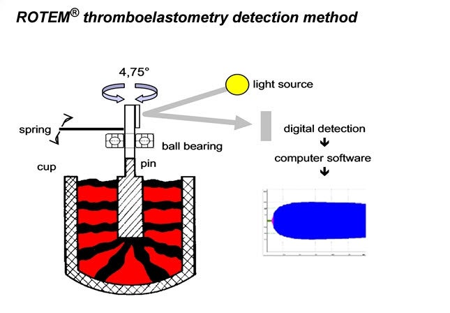 회전 혈전탄성측정법(ROTEM), 응고병증 지혈장애를 조기에 분석하는 유용한 검사법 : 네이버 블로그