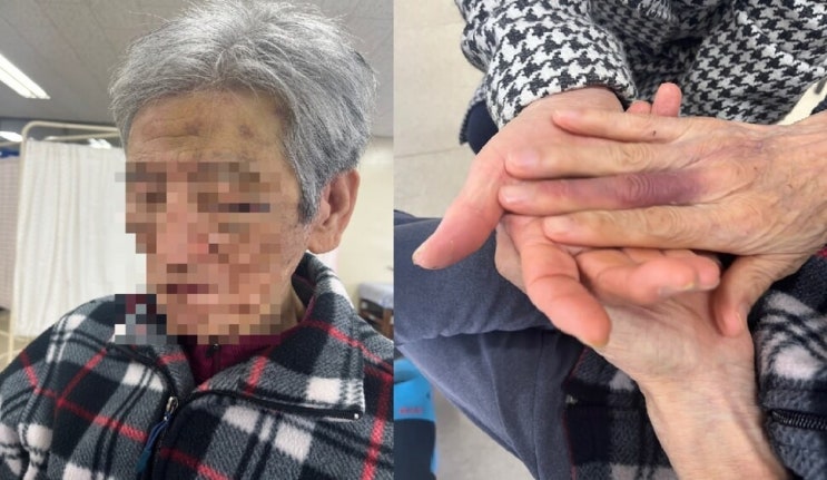 “부모님 맡길 수 있나”…요양원서 23일 만에 맞아 숨진 노인 “부모님 맡길 수 있나”…요양원서 23일 만에 맞아 숨진 노인