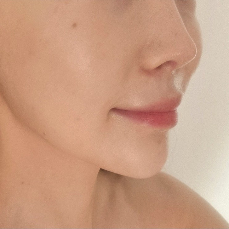  선릉 피부관리 건조한 피부에 수분폭탄 발삼케어 후기