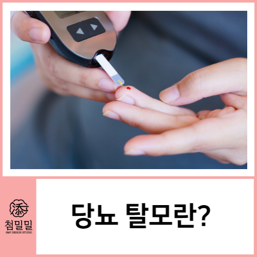  당뇨탈모 생기는 이유, 탈모커버 SMP 포항 첨밀밀에서 알려드려요