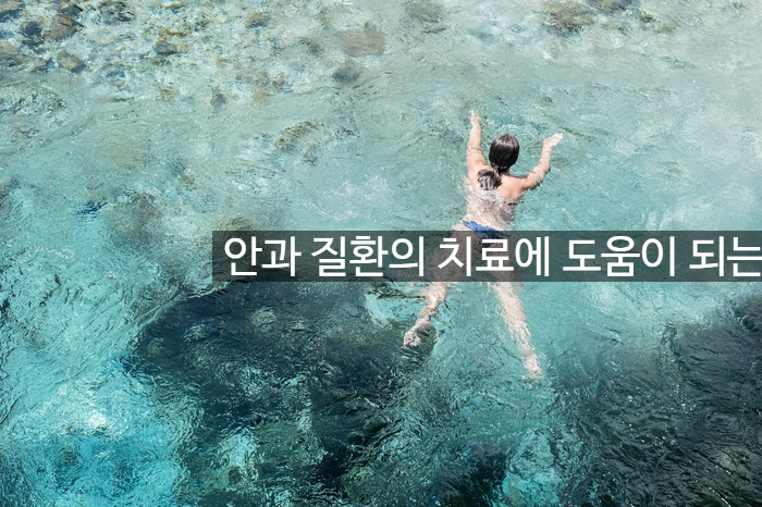  안과 질환의 치료에 도움이 되는 OCUSIL