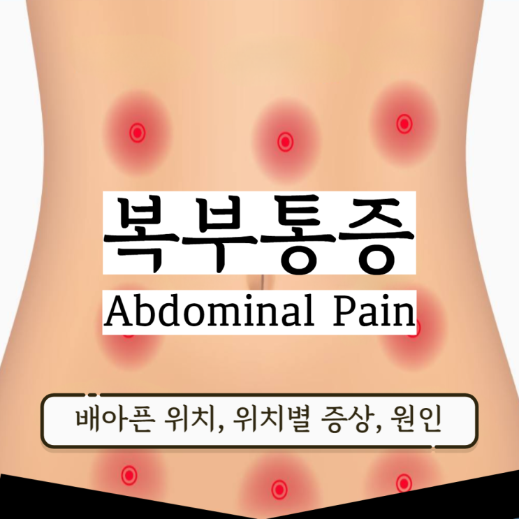 복통 위치 설사 배아픈위치 복통 원인 (아랫배 윗배 명치) 복통 위치 설사 배아픈위치 복통 원인 (아랫배 윗배 명치)