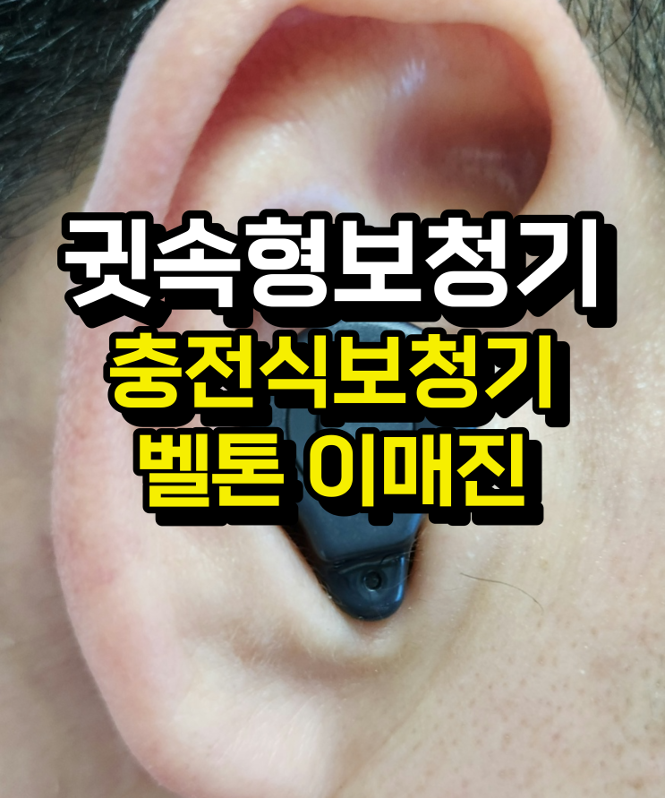  귓속형보청기 신제품 충전식으로 나왔어요 [이매진커스텀]