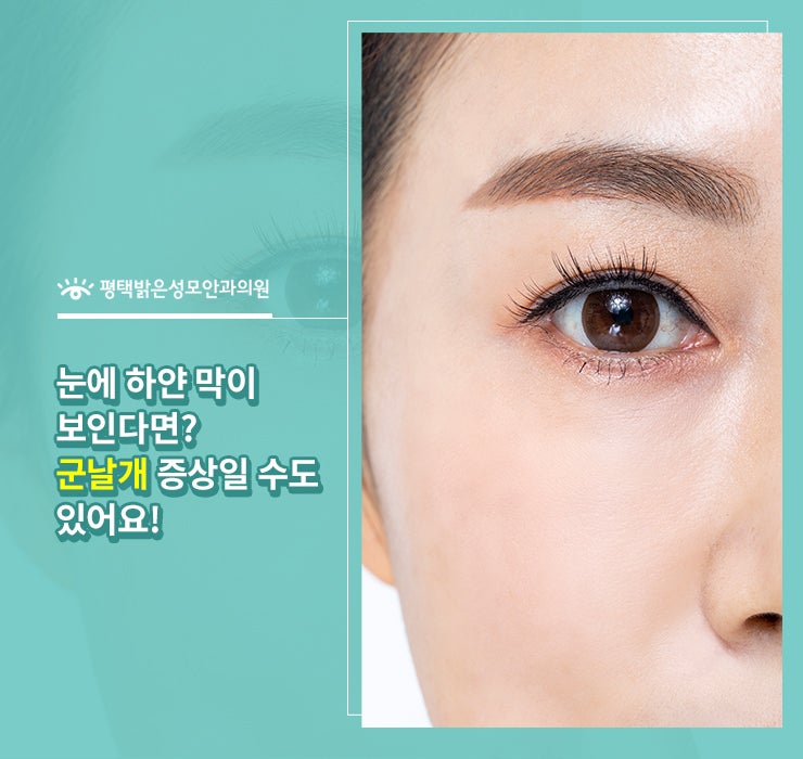 눈에 하얀 막이 보인다면? 군날개 증상일 수도 있어요!