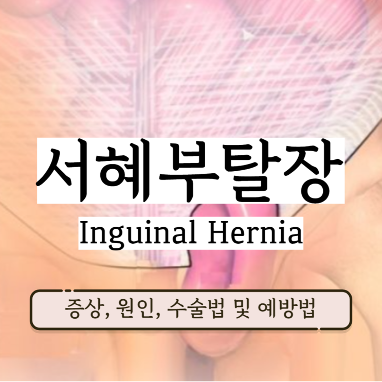 서혜부 탈장 증상 탈장수술방법 원인 예방법 서혜부 탈장 증상 탈장수술방법 원인 예방법