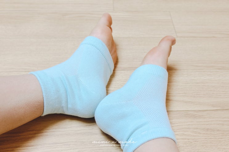  발뒤꿈치 갈라짐 에코후레쉬 발뒤꿈치 패드 믿어봐