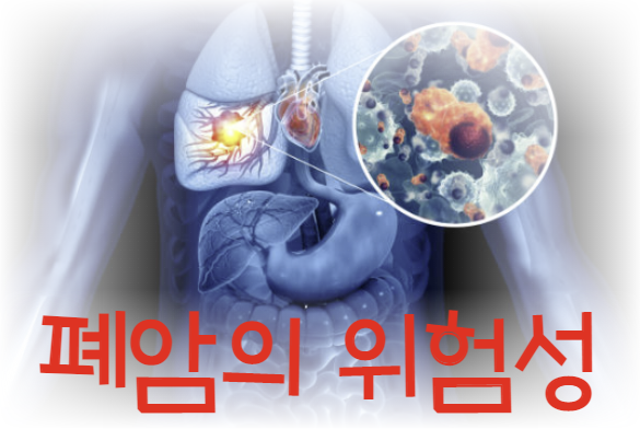 폐암의 유형, 증상 및 치료방법 알아보기