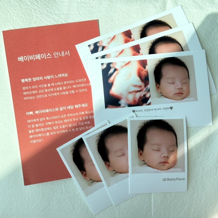  베이비페이스 후기 할인코드 30주차 정밀 입체 초음파