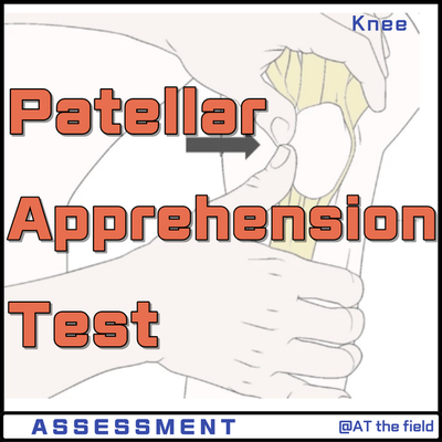 Patellar Apprehension Test / patella disloscation / 슬개대퇴증후군, 슬개골 탈구, 슬개대퇴관절 불안정성