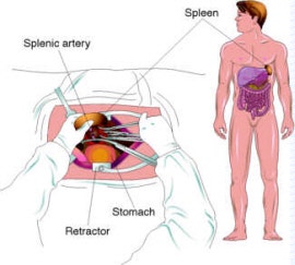 면역성 혈소판감소성 자반증(ITP) 병인, 증상과 치료 : 네이버 블로그