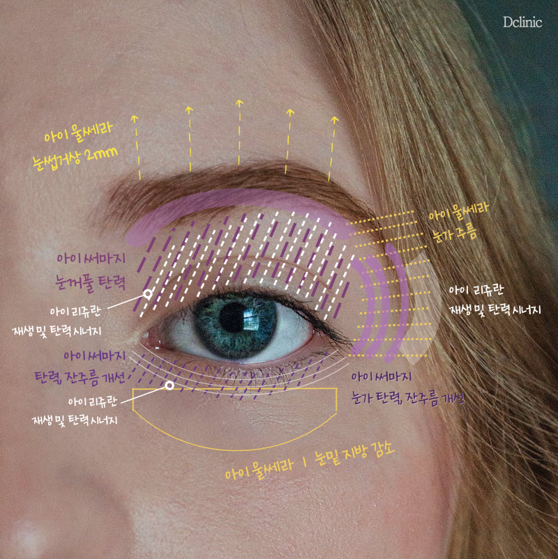 아이서마지 리뷰 조건에 맞는 방향으로 11