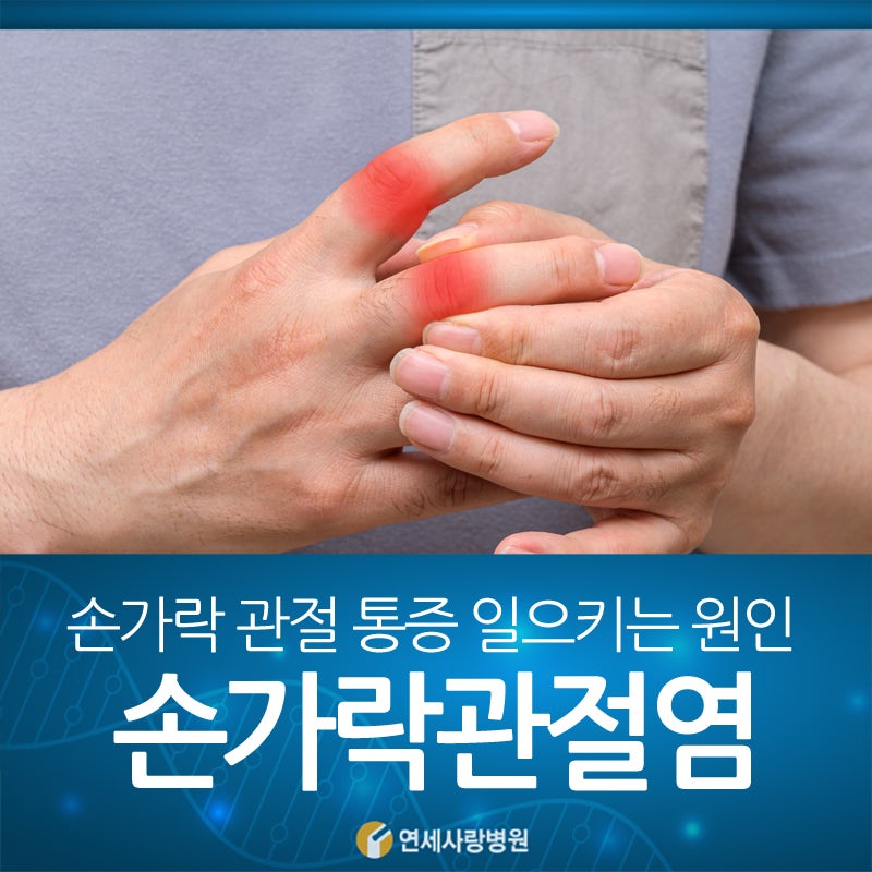 손가락의 골관절염을 치료하는 방법