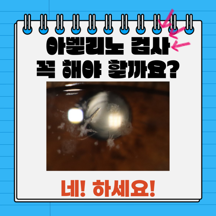  아벨리노 검사 꼭 해야만 하는 걸까요?