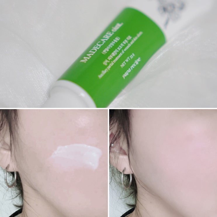  시카크림 센텔라스카 마데케어 연고 환절기 피부 진정에 써봄