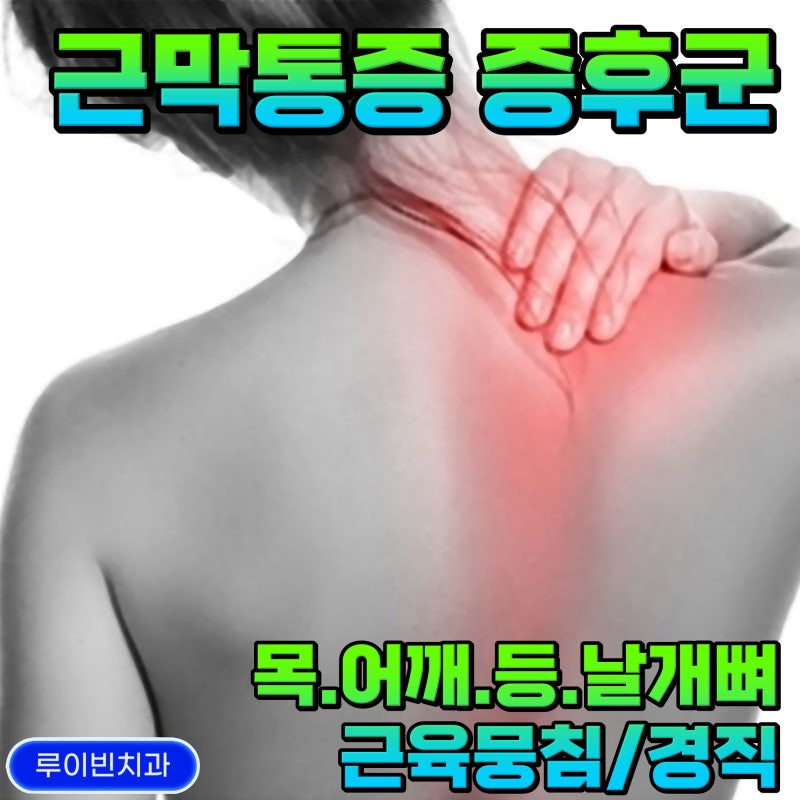 근막 통증 증후군