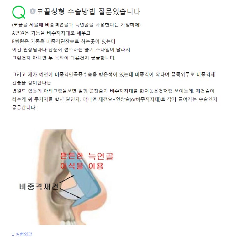  코끝성형, 수술 방법 질문!(서울코수술전문 성형외과)