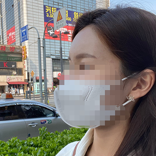  이마지방이식만으로도 얼굴 이미지 개선, 강남지방이식잘하는곳 치유