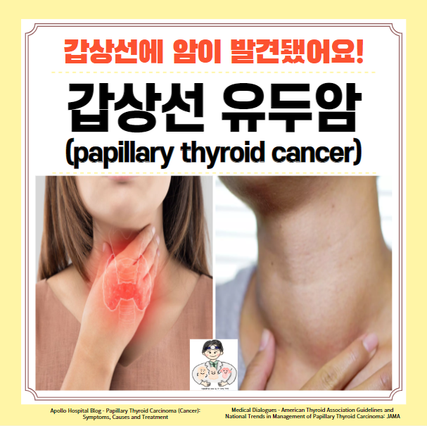  갑상선암 (1) - 갑상선 유두암 원인 증상 진단 치료 수술 예후 병기