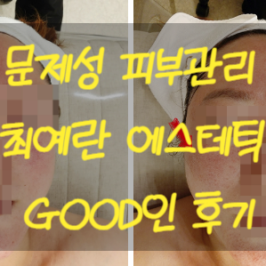  청주 얼굴수분관리 최예란 에스테틱 문제성피부관리 전문이었어요
