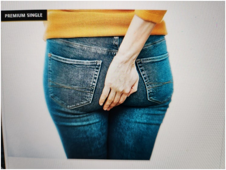 항문 간지러움 증상, 대처방법