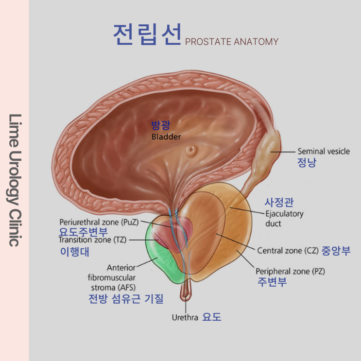  [전립선염2]대구 동구 라임비뇨기과에서 알아보는 전립선염의 증상과 진단