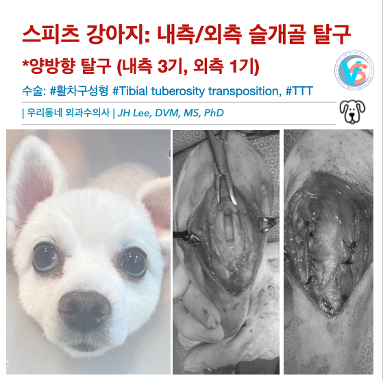  스피츠 강아지 내측/외측 슬개골탈구 (feat, 양측, 양방향 슬개골 탈구), 수술할 때 주의사항 및 팁들 !!