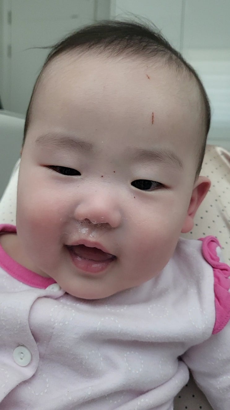  [191일차]쌍둥이는 감기도 옮네요ㅠㅠ