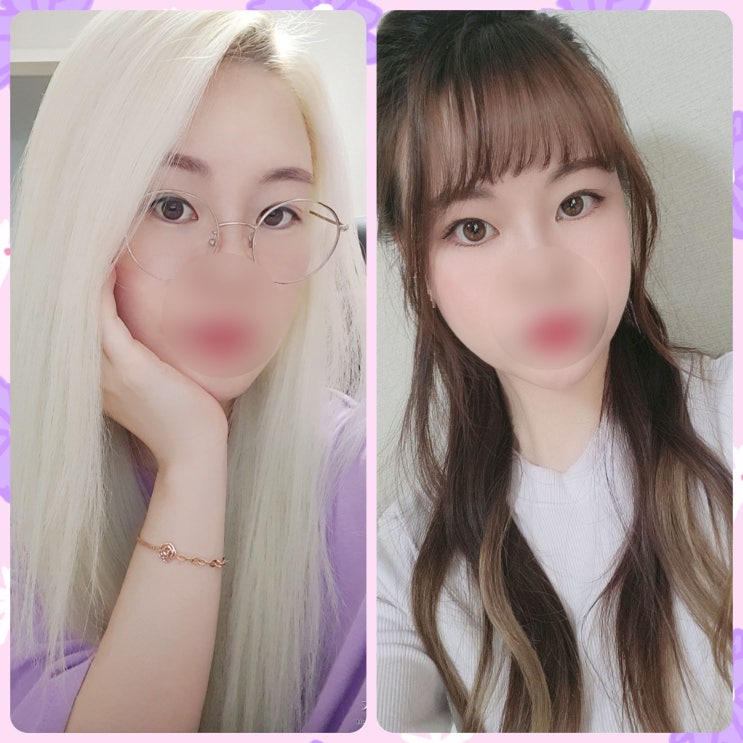  일상 ) ' 스마일라식 후기 ' 수술, 회복 1년 반 후 요즘 (Feat. 수원)