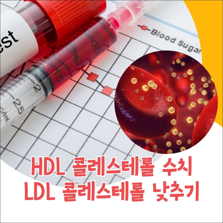 HDL콜레스테롤 수치, LDL콜레스테롤 낮추는 방법