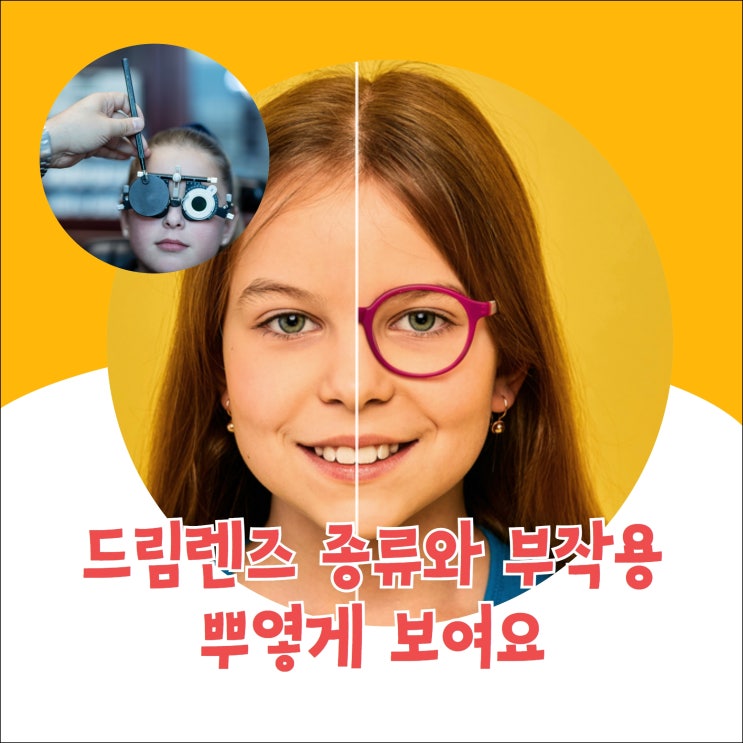  드림렌즈 부작용, 뿌옇게 보여요 #2주무료착용 가능한 안과