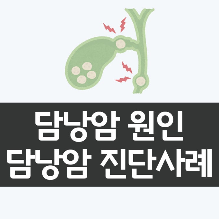  담낭암의 원인 및 증상과 진단사례