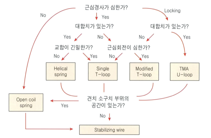  [치과교정학] 구치직립장치 선택을 위한 가이드라인