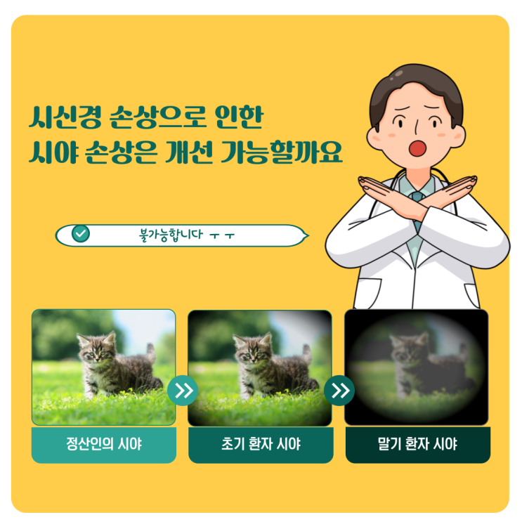  시신경 손상으로 인한 시야 손상은 치료 가능할까요