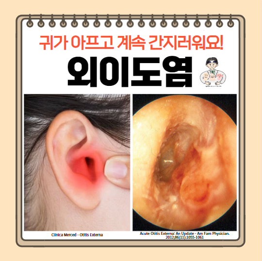  외이도염 귀 통증 귀염증 원인 증상 진단 치료