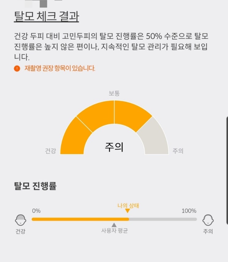 <탈모원격치료> 위드비컨 두피스캐너 두피진단기