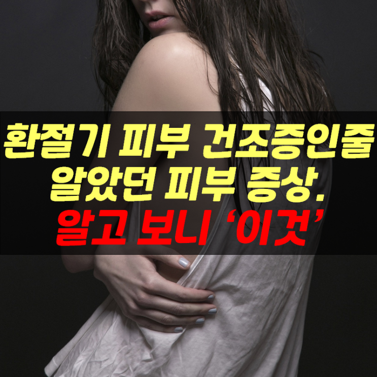  환절기 피부 건조증인 줄 알았던 피부 증상 알고 보니 '이것'