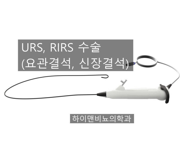 요로결석, 신장결석 수술 방법: URS, RIRS 수술