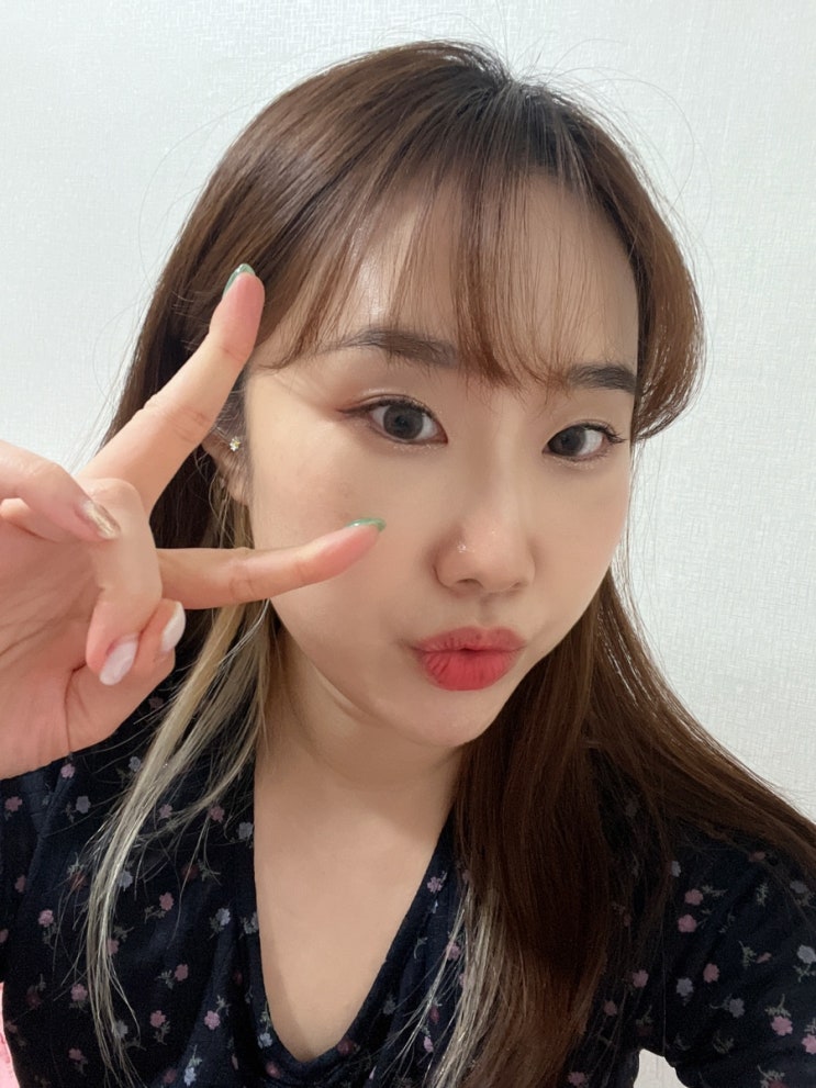 압구정피부과 올리지오리프팅 후기 피부탄력개선 지렸음