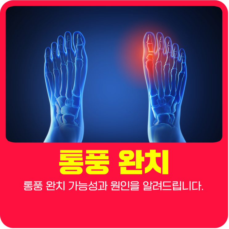  통풍 완치 가능성과 원인을 알려드립니다.