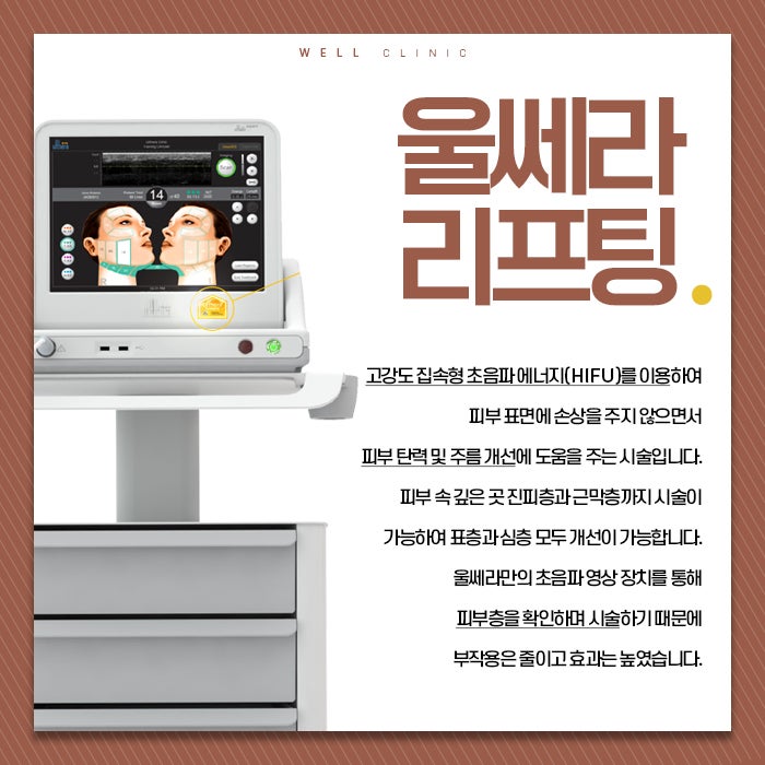 순천리프팅울테라 효과 및 사용방법