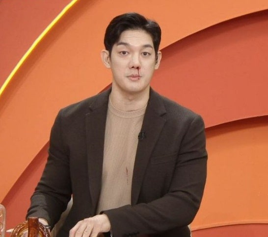 생방송 도중 코피 터진 박재민 아나운서
