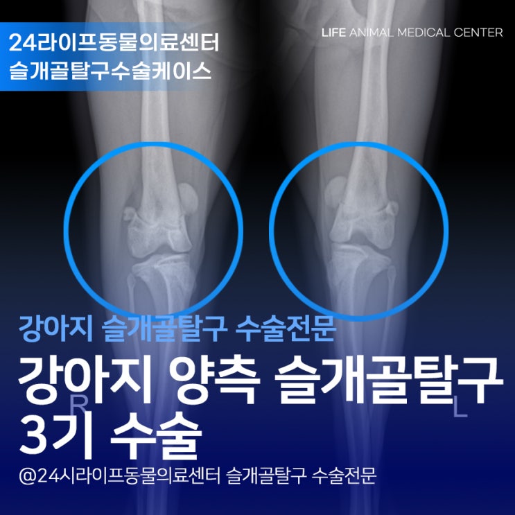 대구 강아지 슬개골 탈구수술 : 푸들 양측 슬개골탈구 3기 수술 대구 강아지 슬개골 탈구수술 : 푸들 양측 슬개골탈구 3기 수술