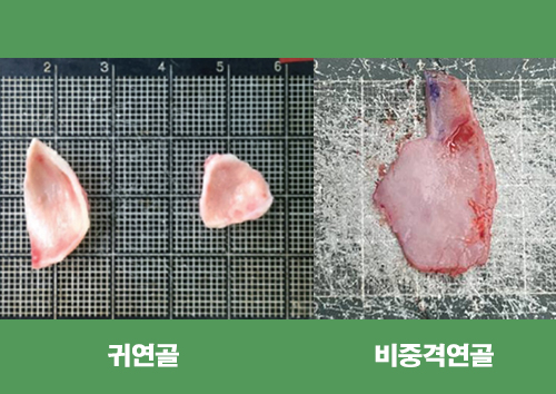  코수술 재료 장단점? 자가연골(비중격, 귀연골)은 흡수 잘 되나요?