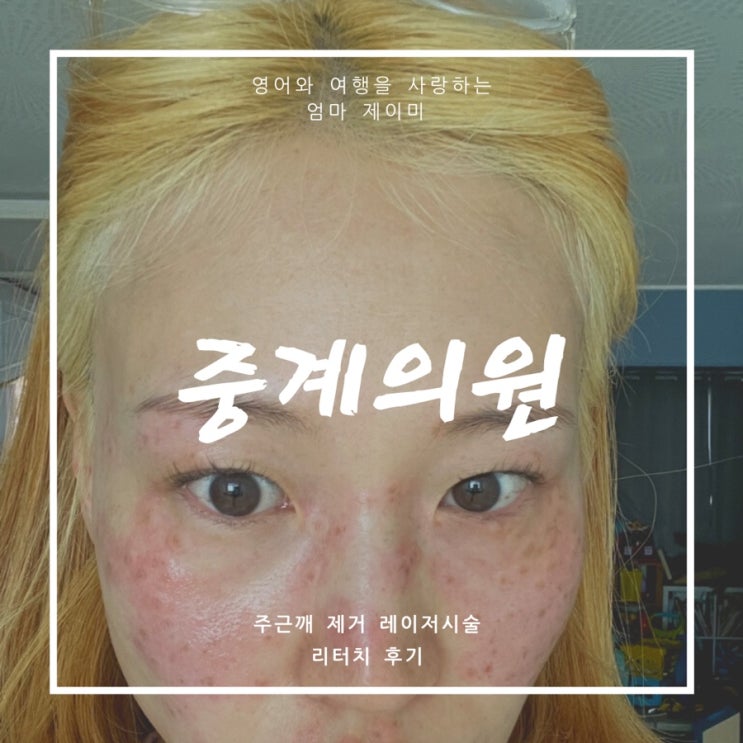  중계의원 후기 / 5개월 후 리터치받음!!