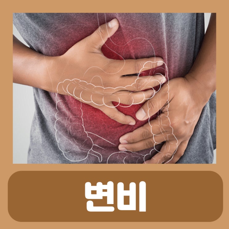  변비 해결 자세 똥 잘나오는 자세 변비약 추천 마그밀정 효과