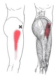 무릎/허리 통증을 유발하는 넙다리근막긴장근(대퇴근막장근)의 트리거포인트(통증유발점) 마사지법/추천운동