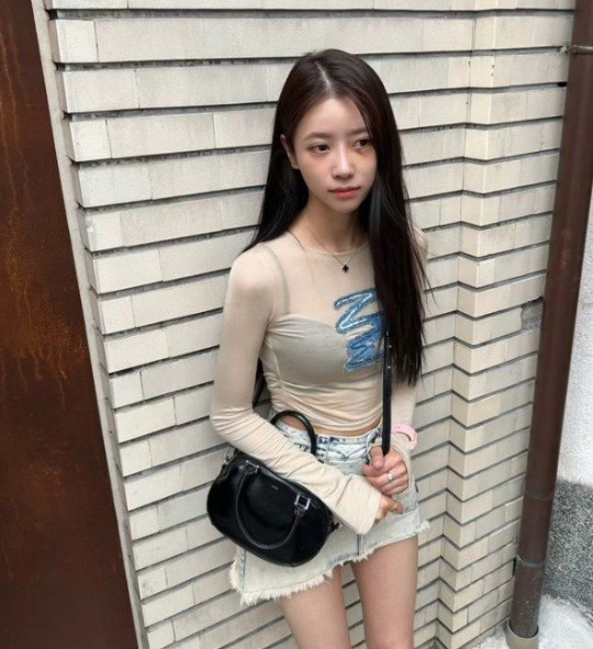  이미주 피멍 눈탱이 러블리즈 이미주, 어쩌다 눈주위에 시퍼런 피멍... 그 이유는?