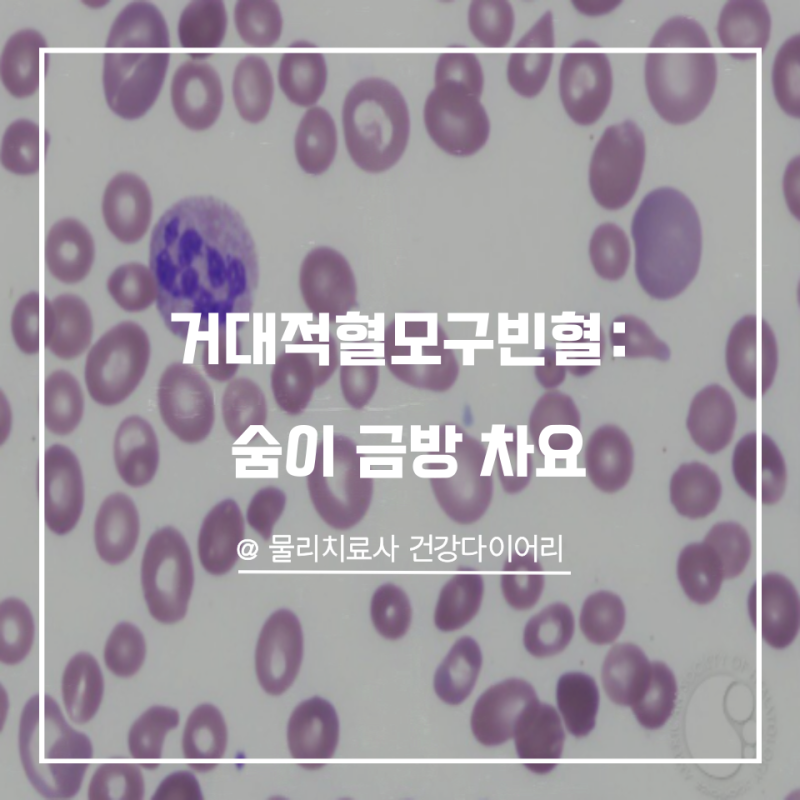 거대적혈모구빈혈: 숨이 금방 차요
