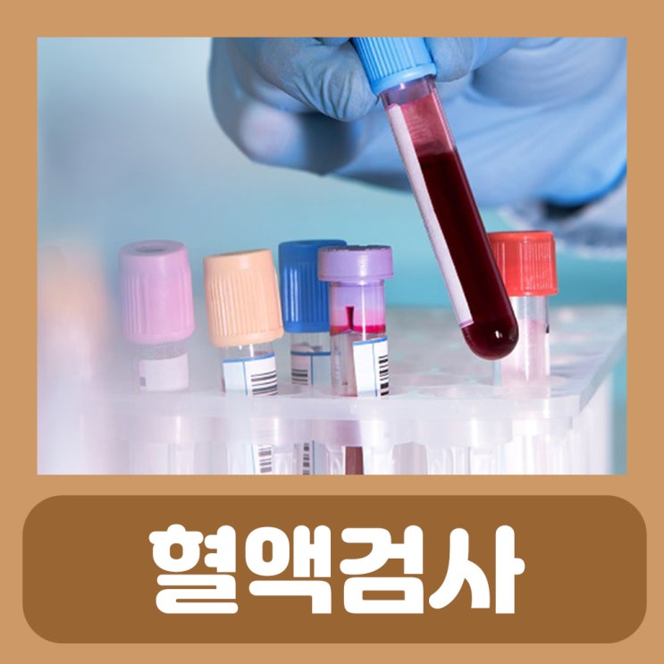 혈액검사 결과 시간 비용 피검사로 알수있는것 보건소 피검사